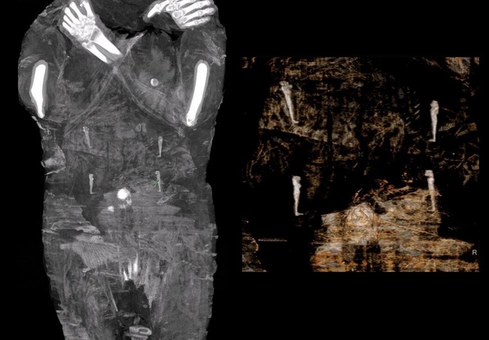 Αρχαιολόγοι ανακάλυψαν την πρώτη έγκυο αιγυπτιακή μούμια - ΔΙΕΘΝΗ