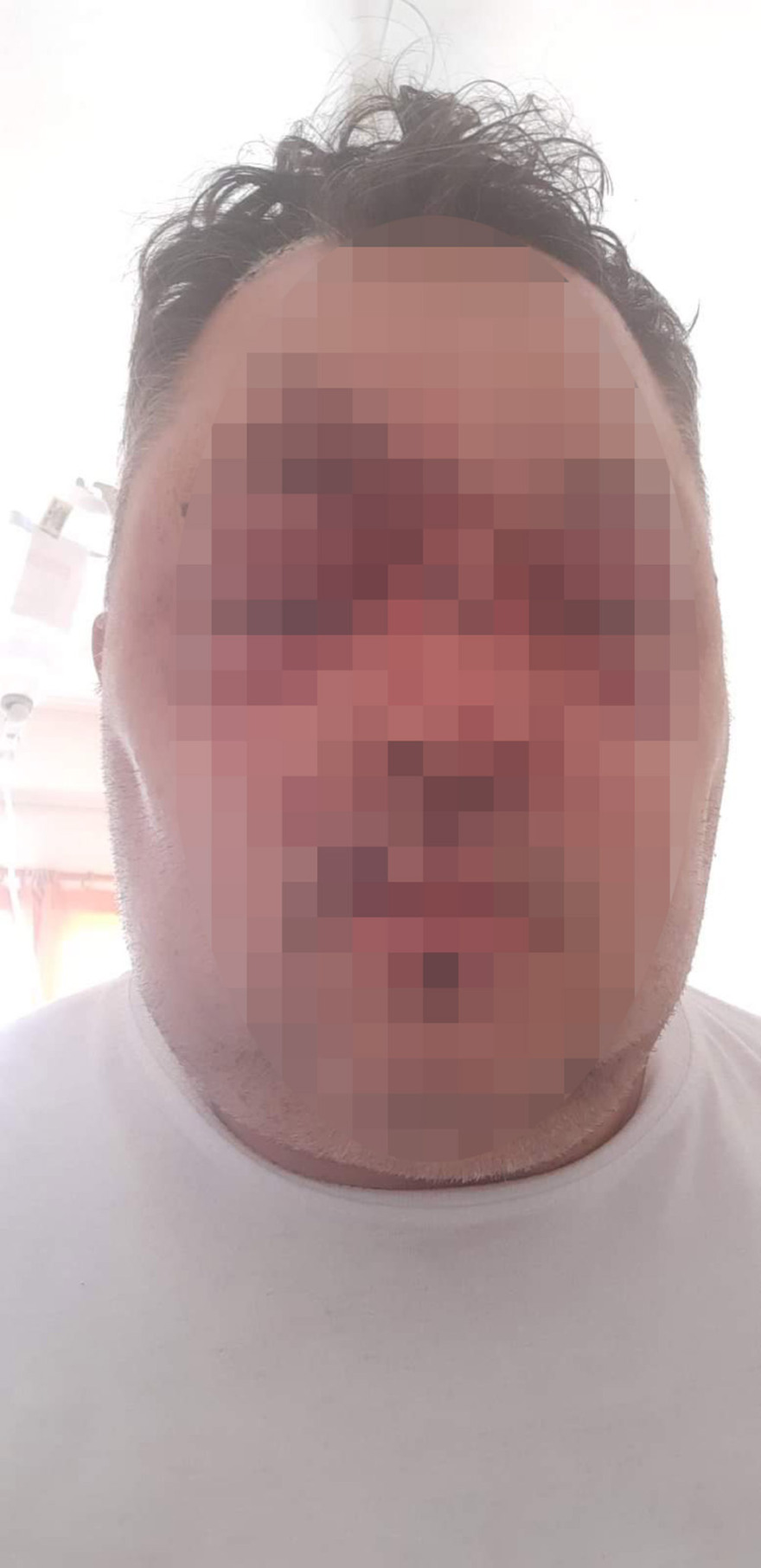 Παξοί: Αλβανός αγρότης σακάτεψε αστυνομικό με σιδερολοστό - ΕΛΛΑΔΑ