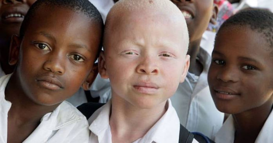 albinos.jpg